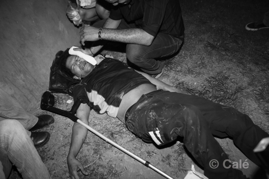 Homem machucado em protesto. Foto: Calé, usada com permissão.